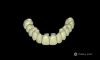 Zirconia Hybrid Full Arch - Design Service - FinalCut™