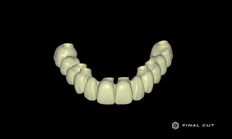 Zirconia Hybrid Full Arch - Design Service - FinalCut™