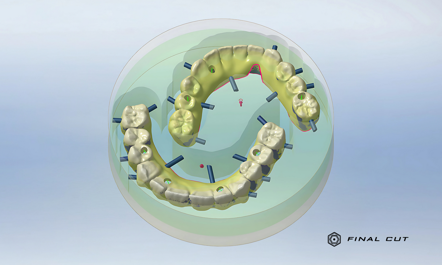Zirconia Full Arch Over Bar - Milling Service - FinalCut™