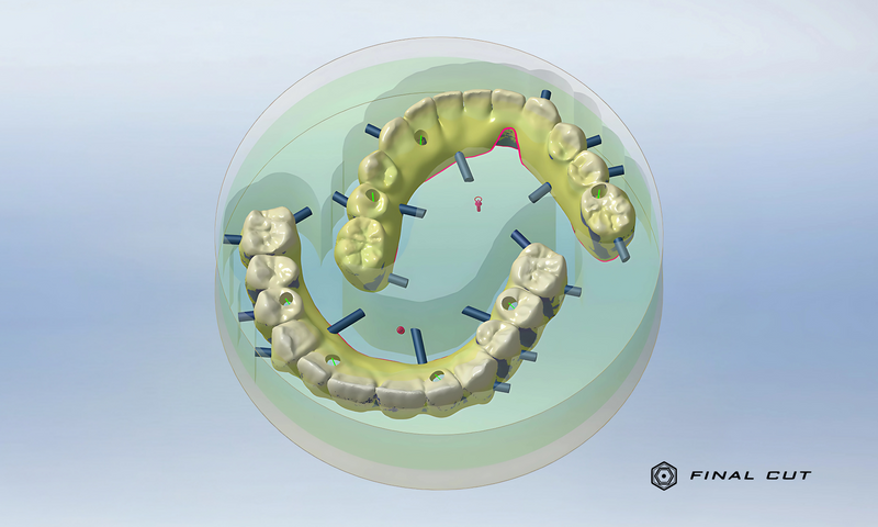 Zirconia Full Arch Over Bar - Milling Service - FinalCut™