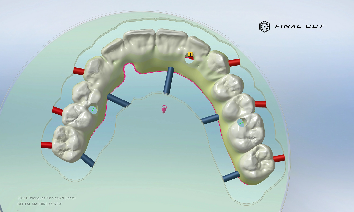 Zirconia Full Arch Over Bar - Milling Service - FinalCut™