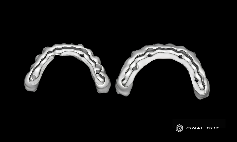 Zirconia Full Arch Over Bar - Design & Milling Service - FinalCut™