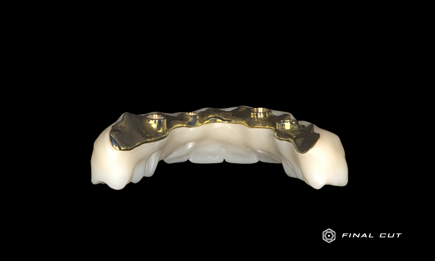 Zirconia Full Arch Over Bar - Design & Milling Service - FinalCut™