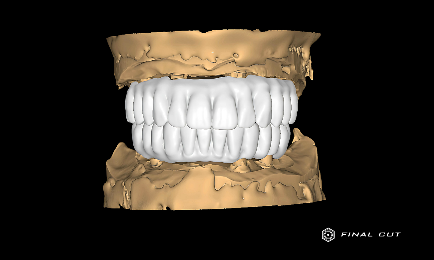 Zirconia Full Arch Over Bar - Design & Milling Service - FinalCut™