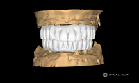 Zirconia Full Arch Over Bar - Design & Milling Service - FinalCut™