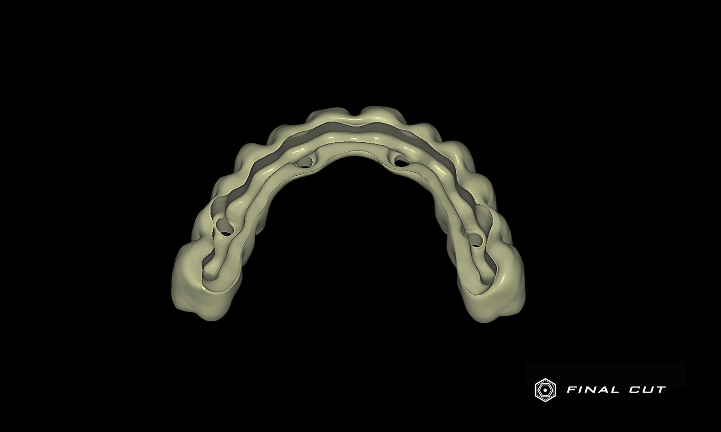 Zirconia Full Arch Over Bar - Design Service - FinalCut™