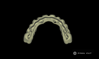 Zirconia Full Arch Over Bar - Design Service - FinalCut™