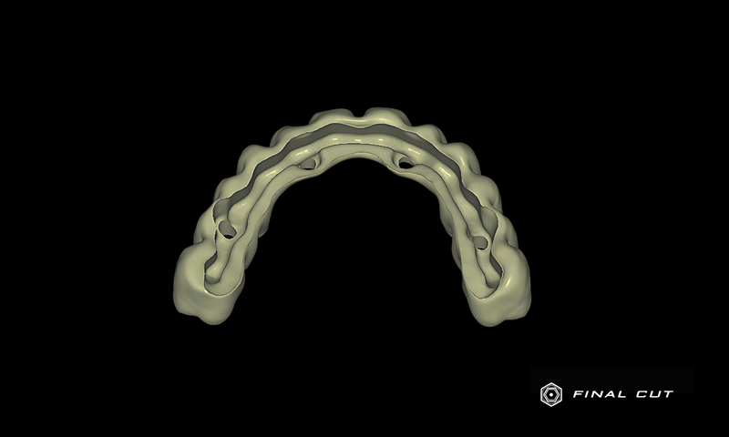 Zirconia Full Arch Over Bar - Design Service - FinalCut™