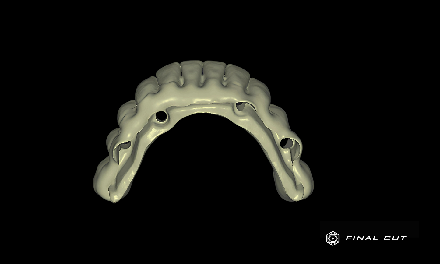 Zirconia Full Arch Over Bar - Design Service - FinalCut™