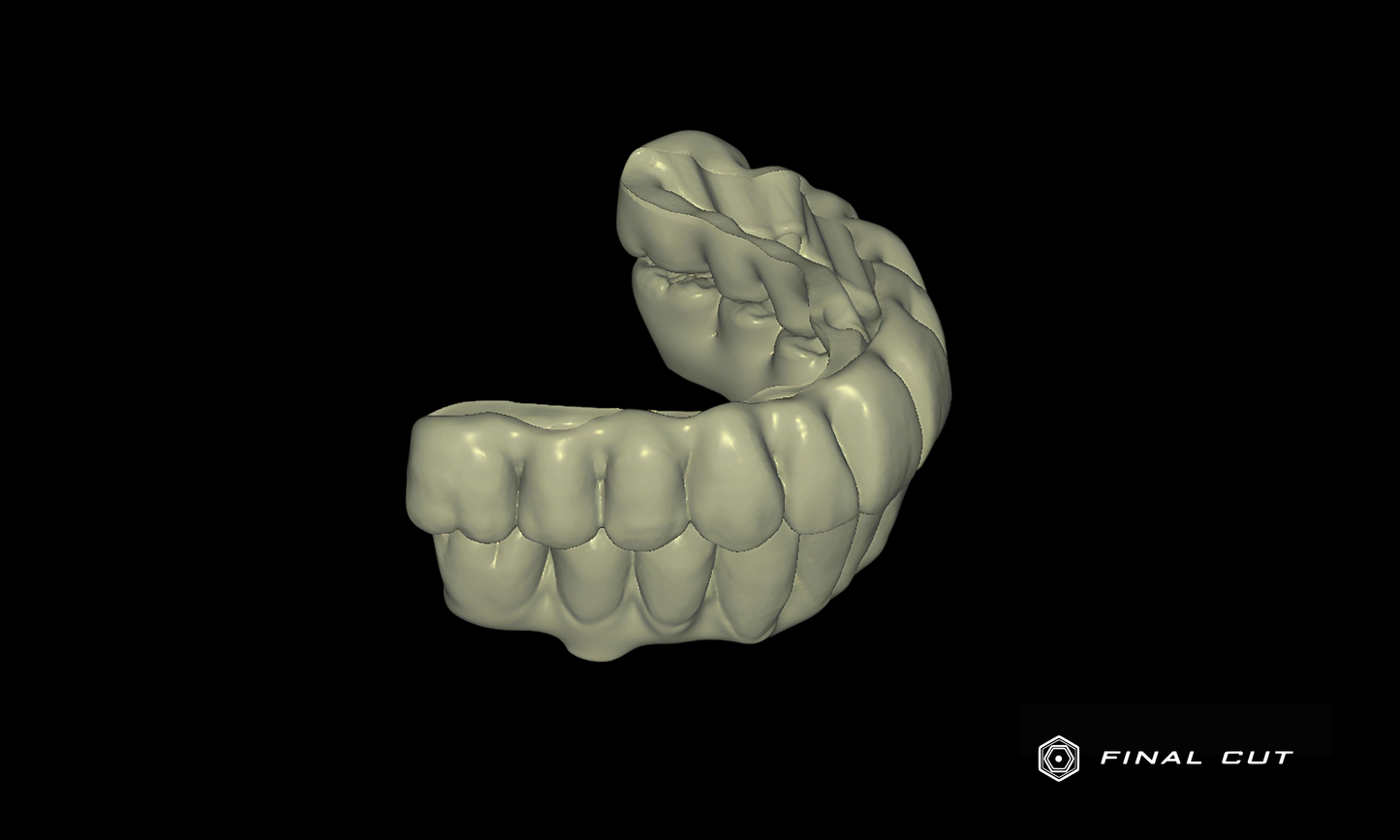 Zirconia Full Arch Over Bar - Design Service - FinalCut™
