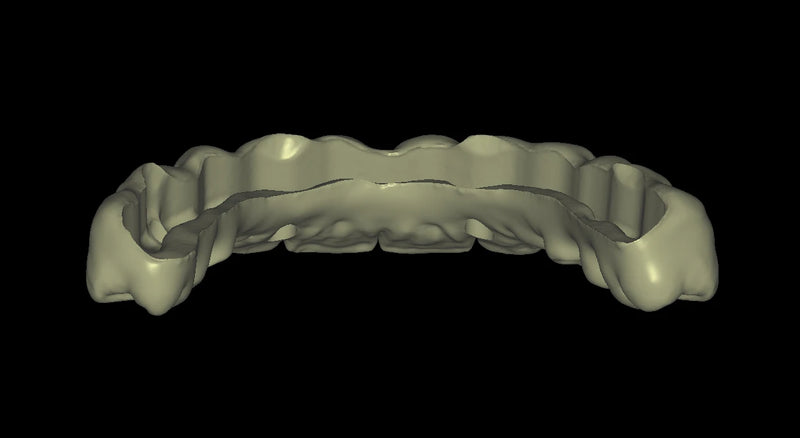 Zirconia Full Arch Over Bar - Design Service - FinalCut™