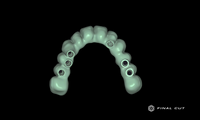 Zirconia Hybrid Full Arch - Design Service - FinalCut™