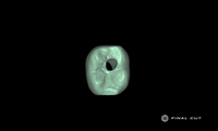 Zirconia Implant Crown & Bridge - Design Service - FinalCut™