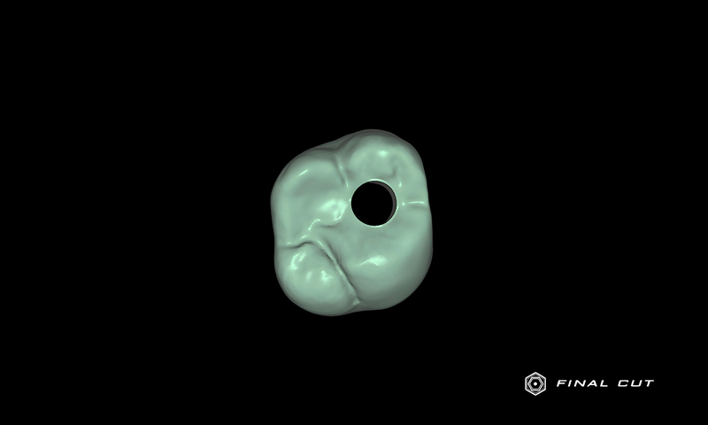 Zirconia Implant Crown & Bridge - Design Service - FinalCut™