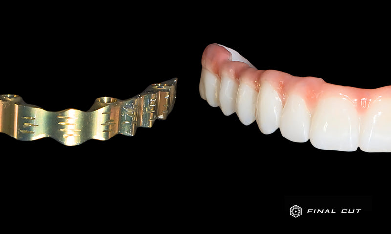 Custom Titanium Bar and Full Arch Zirconia