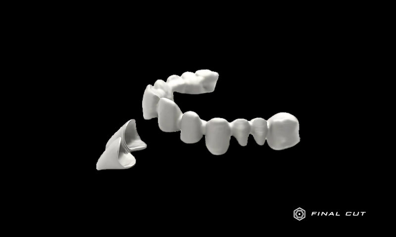 Titanium Coping - Design & Milling Service - FinalCut™