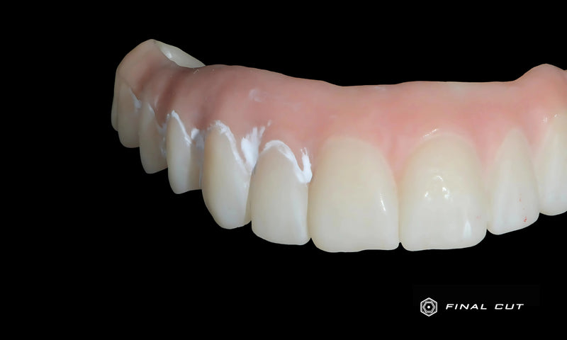 Full Arch with Pink Porcelain No Glazed