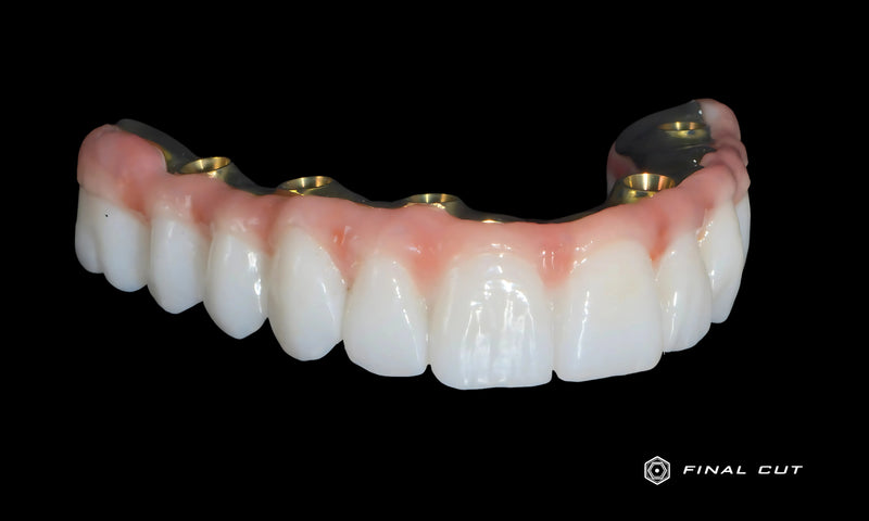 Full Arch Zirconia Pink Porcelain and Titanium Bar