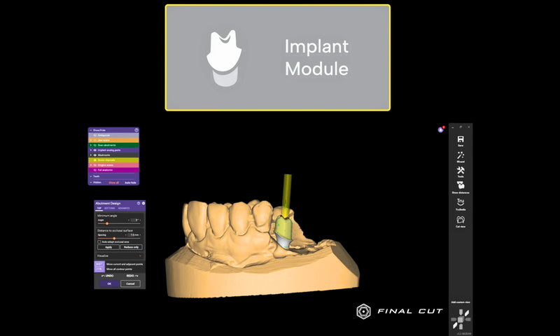 Exocad Software - Implant Package - FinalCut™
