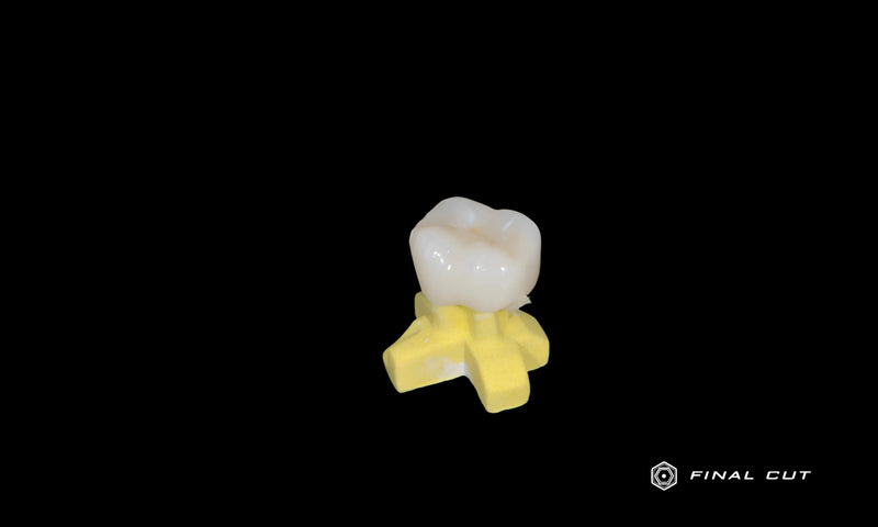 Lower Molar Crown