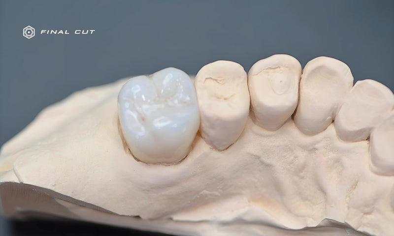 Molar Crown Upper