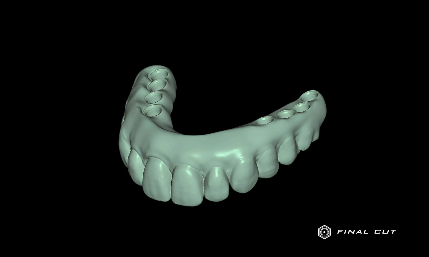 PMMA Hybrid Full Arch - Design & Milling Service - FinalCut™