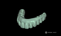 PMMA Hybrid Full Arch - Design & Milling Service - FinalCut™