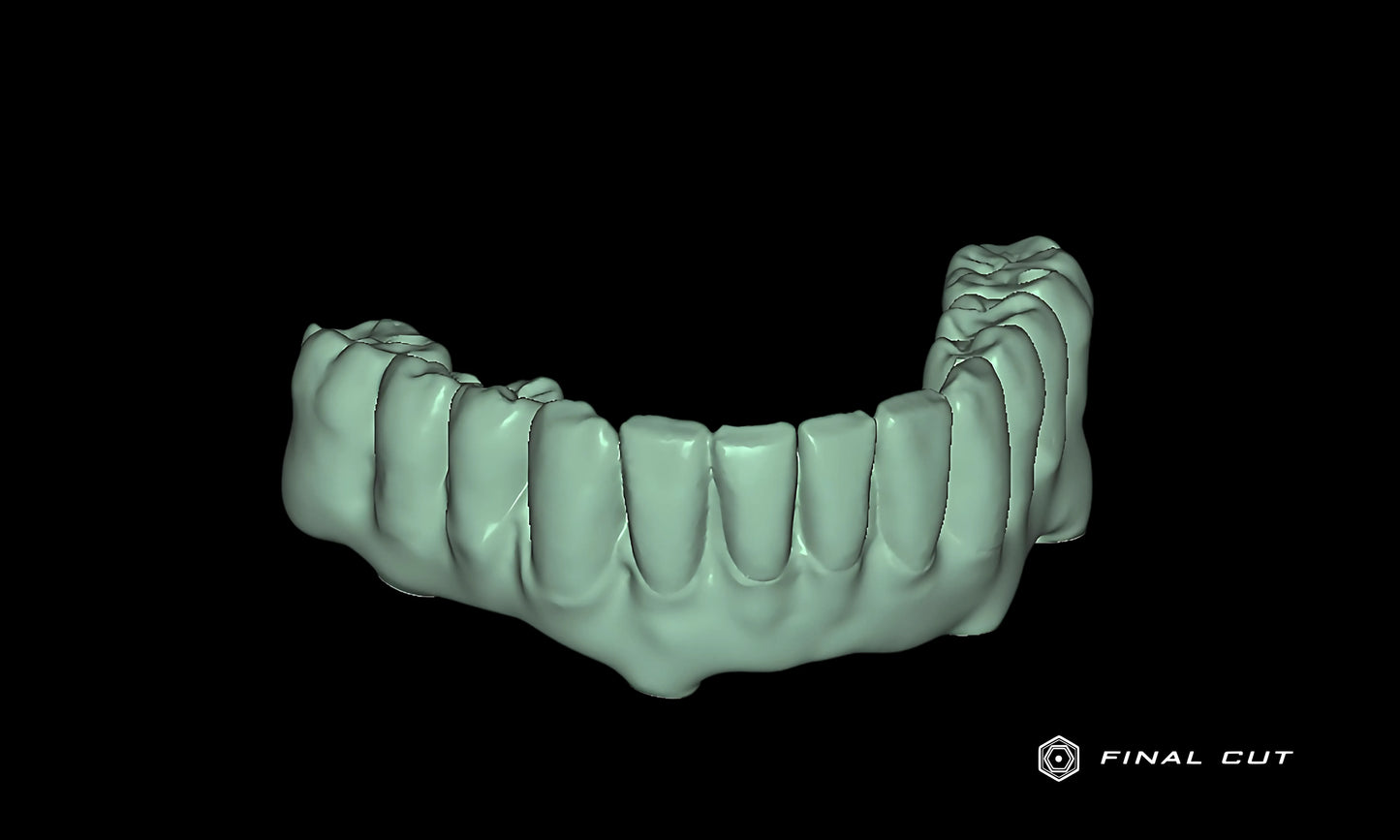 PMMA Hybrid Full Arch - Design & Milling Service - FinalCut™