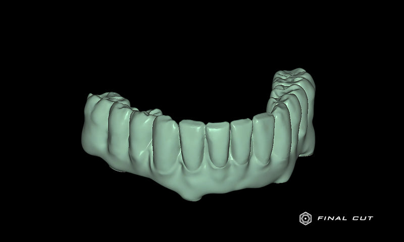 PMMA Hybrid Full Arch - Design & Milling Service - FinalCut™