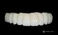 PMMA Hybrid Full Arch - Design & Milling Service - FinalCut™