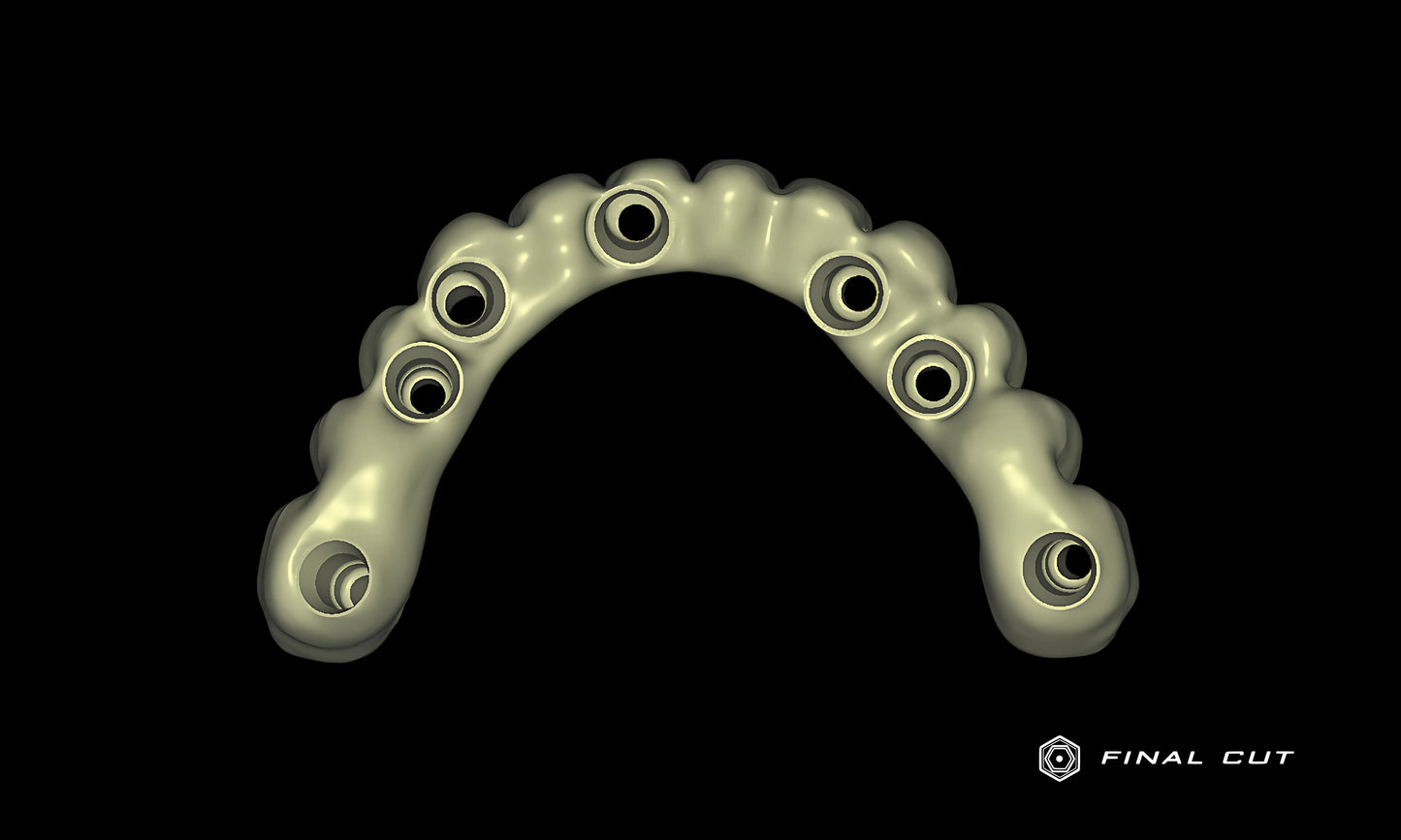 PMMA Hybrid Full Arch - Design Service - FinalCut™