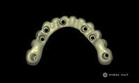 PMMA Hybrid Full Arch - Design Service - FinalCut™