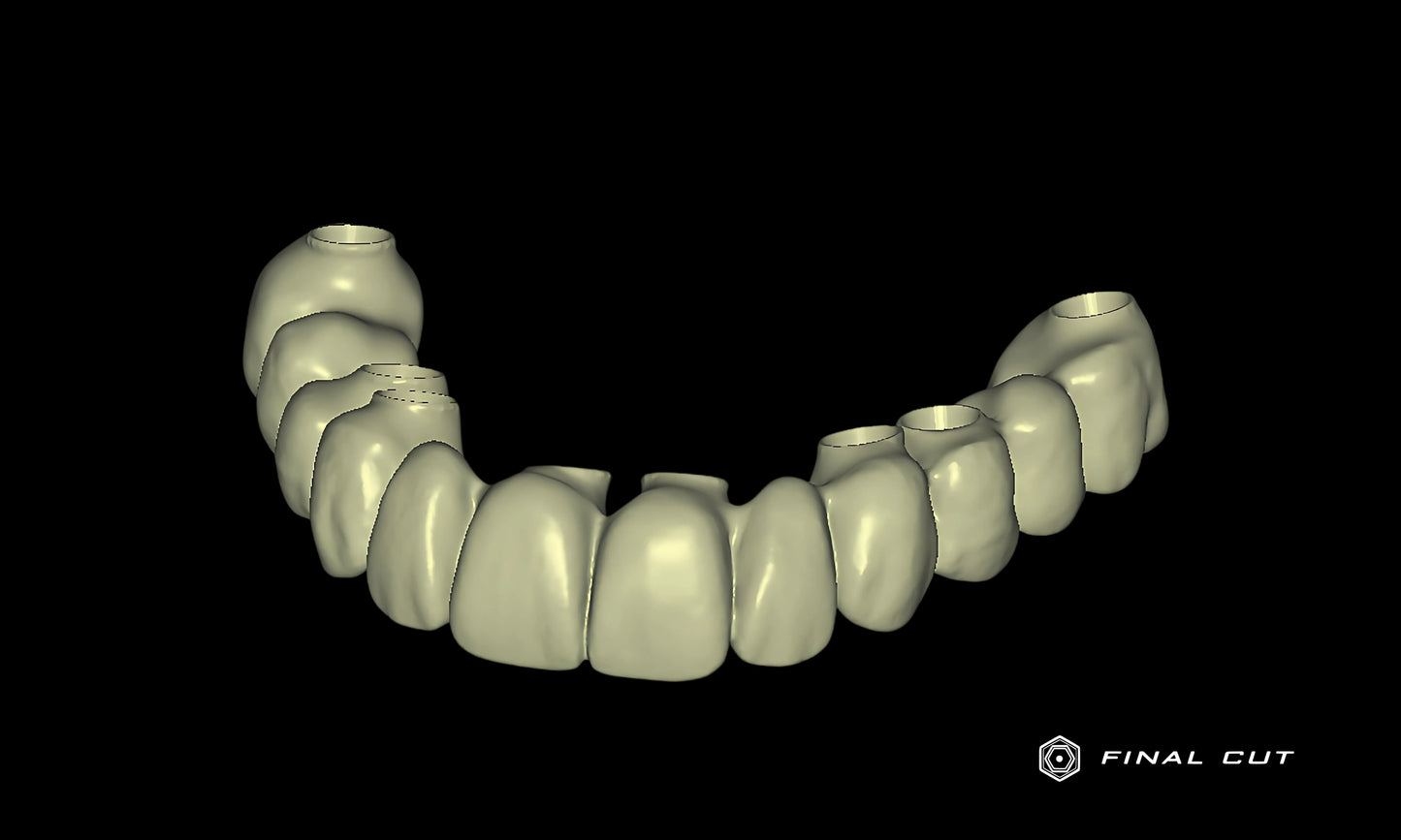 PMMA Hybrid Full Arch - Design Service - FinalCut™