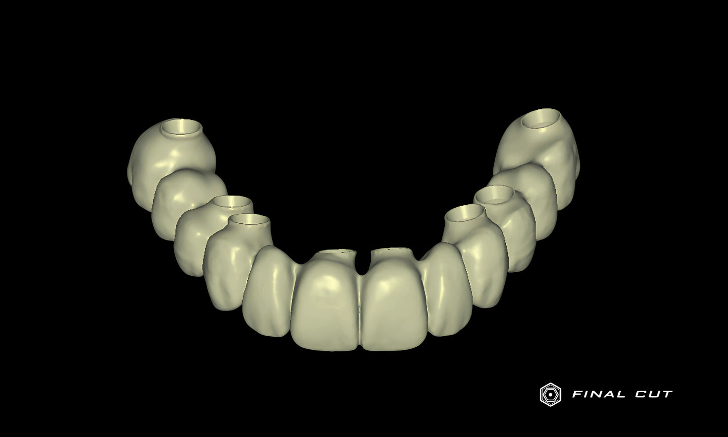 PMMA Hybrid Full Arch - Design Service - FinalCut™
