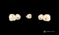 PMMA Implant Crown & Bridge - Milling Service - FinalCut™