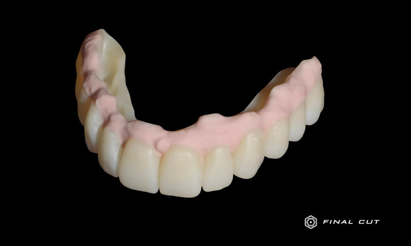 Porcelain Pink Application over Full Arch