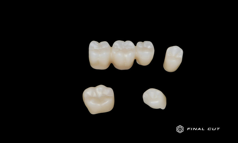 Posterior Crown and Bridge