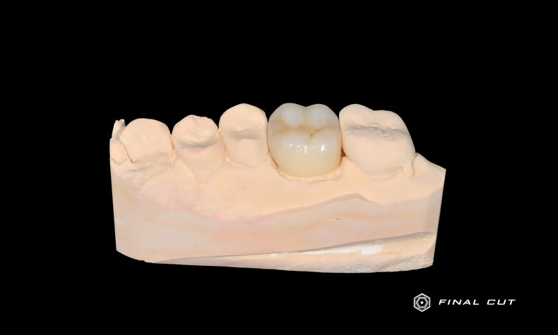Posterior Crown Upper Molar