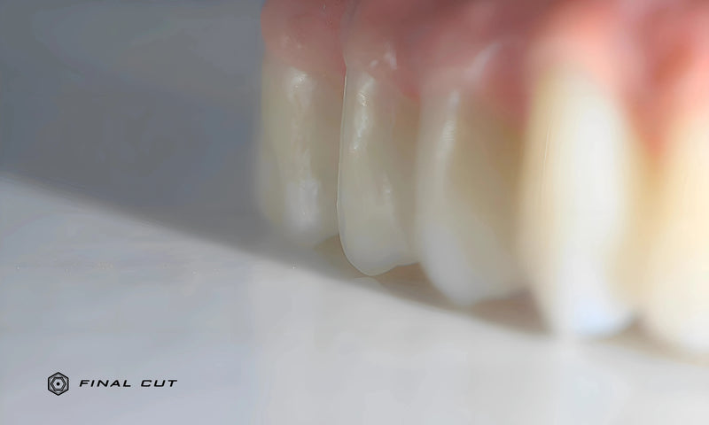 Posterior Full Arch Pink Porcelain