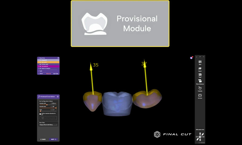 Exocad Software - Implant Package - FinalCut™