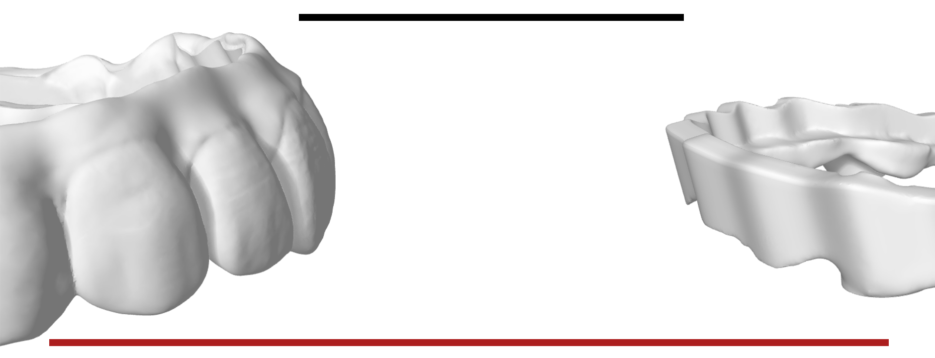 Zirconia Digital Dental CAD-CAM EXOCAD MILLBOx HYPERDENT 3Shape