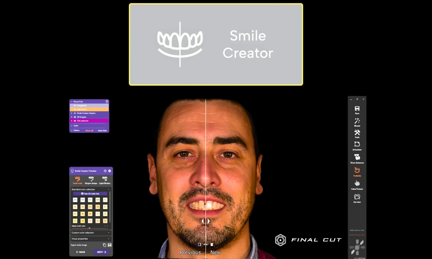 Exocad Software - Ultimate Package - FinalCut™