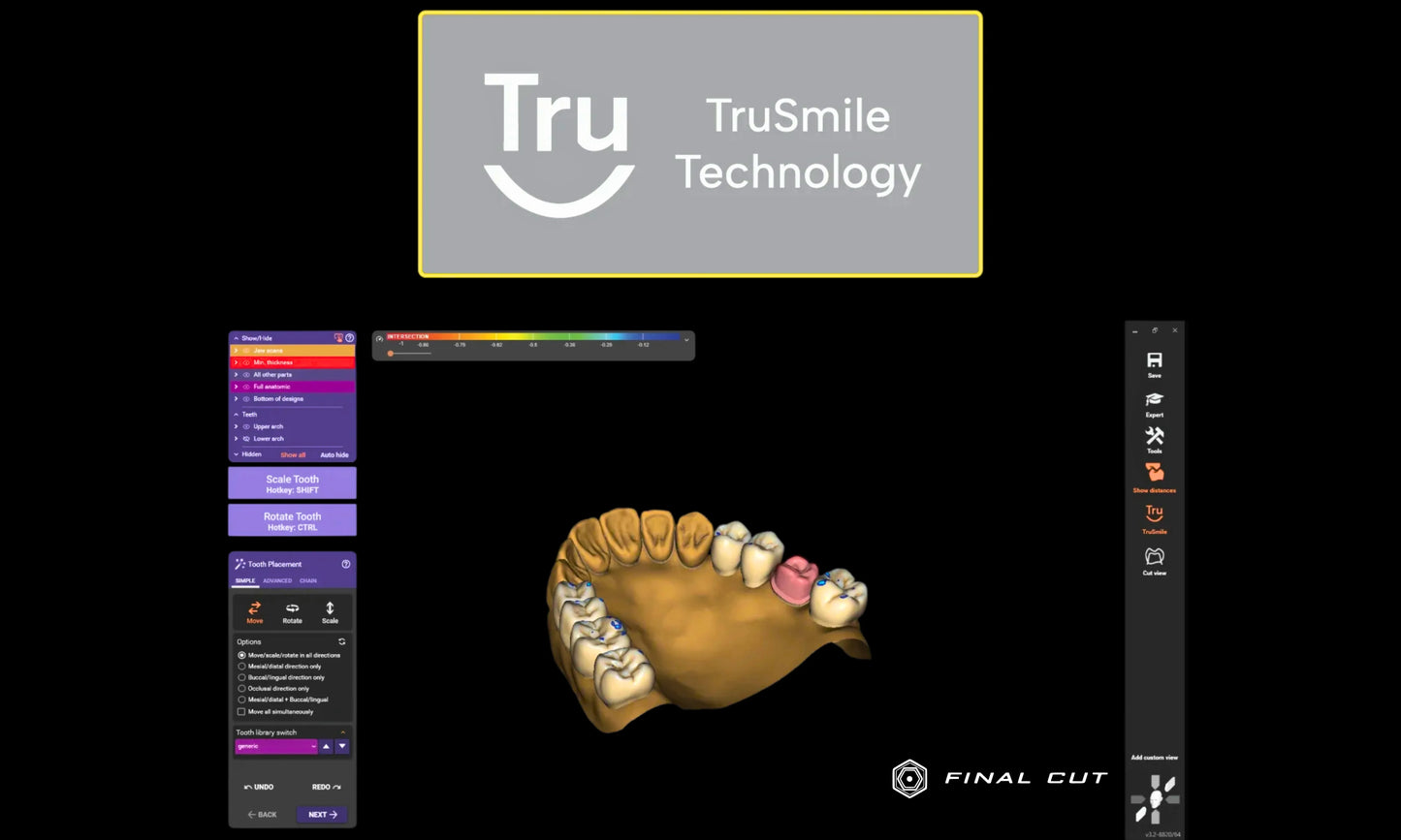 Exocad Software - Implant Package - FinalCut™