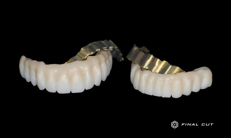 Upper and Lower Zirconia Full Arch Over Bar