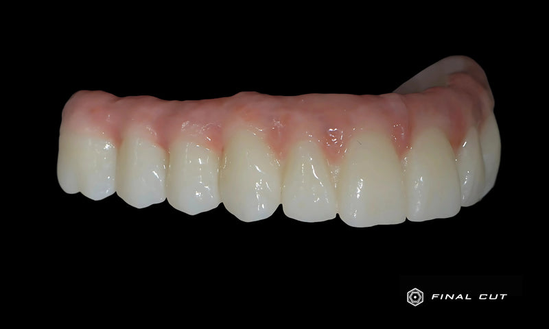 Upper Full Arch in Zirconia and Pink Porcelian