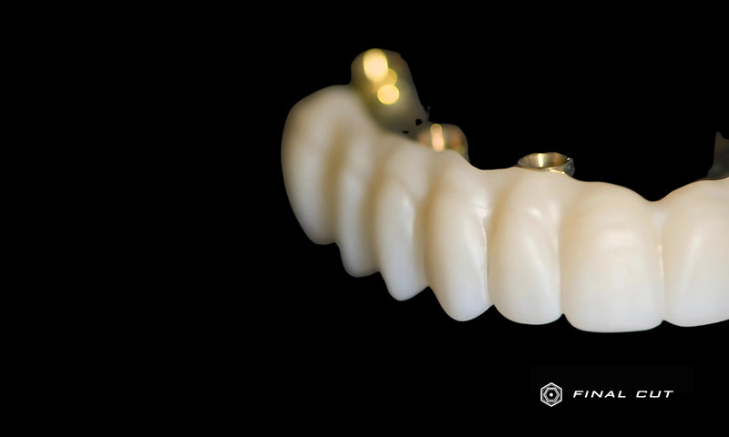 Upper Full Arch over Titanium Bar