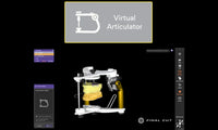 Exocad Software - Implant Package - FinalCut™