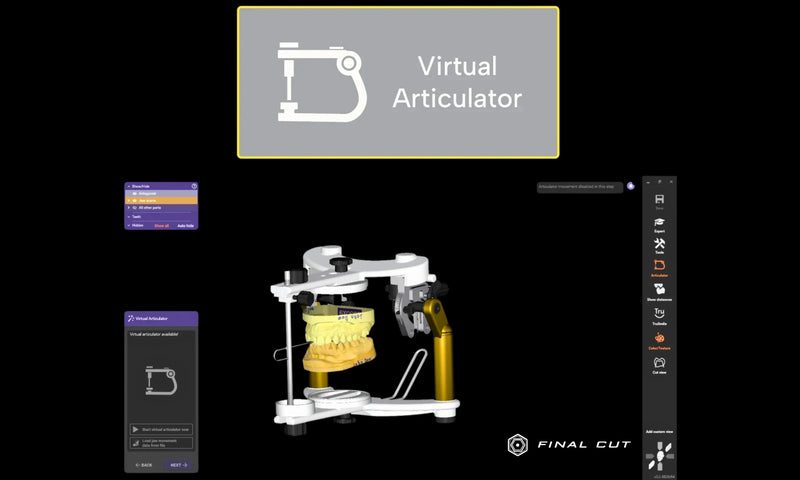 Exocad Software - Implant Package - FinalCut™