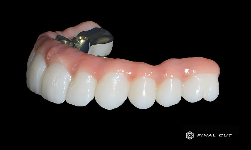 Zirconia Frame and Titanium Bar