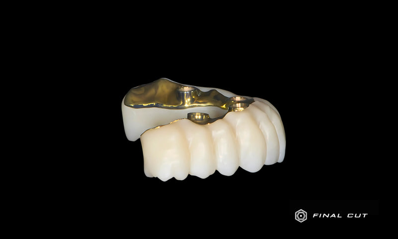 Zirconia Full Arch Over Bar